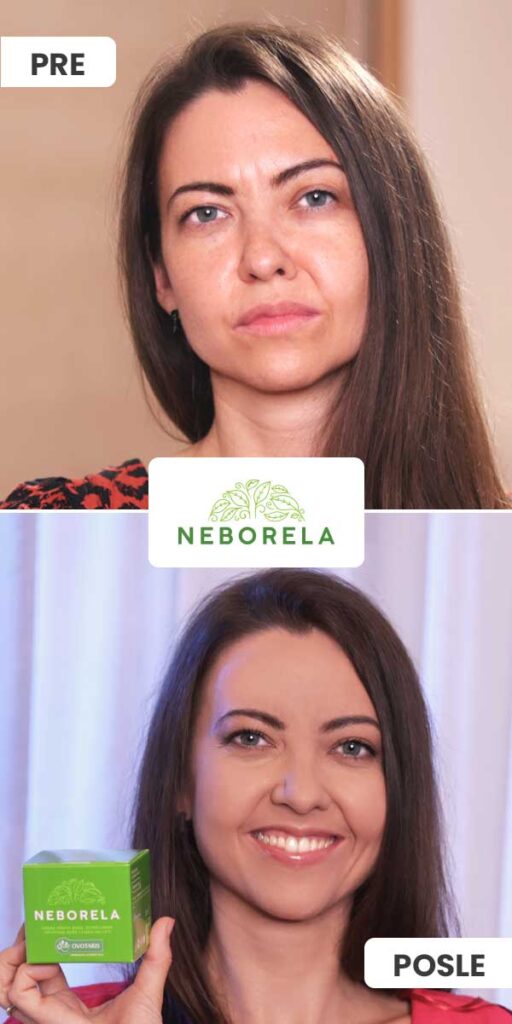 neborela-iskustvo-pre-posle1 neborela iskustvo pre posle